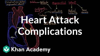 Complications after a heart attack myocardial infarction  NCLEXRN  Khan Academy [upl. by Henricks]