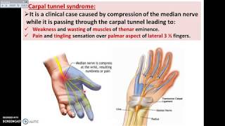 Wrist and Hand Joints  3D Anatomy Tutorial [upl. by Khano764]