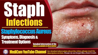 Staphylococcus Aureus Symptoms Treatment And Prevention [upl. by Sellig324]