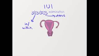 What is IUI Intrauterine Insemination [upl. by Butler714]