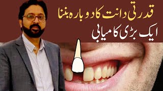 How to REGROW Your Teeth Naturally with a Japanese Research Medicine [upl. by Arukas]