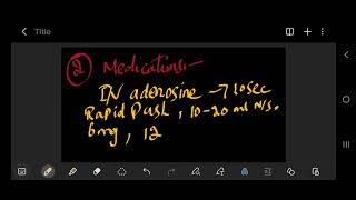 Supraventricular Tachycardia svt [upl. by Roybn]