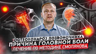 Остеохондроз  Причины симптомы лечение остеохондроза  Как вылечить остеохондроз [upl. by Drofnas]