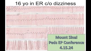 Mount Sinai Pediatric EP Conference 41524 [upl. by Ahsitahs124]