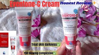 EventoneC Cream  Medicated cream for Skin Whitening 🤩 EventoneC Cream Review✨ [upl. by Nossah779]