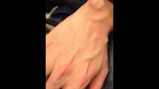 Moving veins on the dorsum of your hand [upl. by Lemrej472]