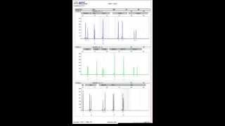 Explication danalyse dun testpaternité entre le père présumé et lenfant vidéo 4 [upl. by Ocsic182]