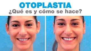 Otoplastia Qué es y Cómo se hace la Cirugía de Orejas  Clínicas Diego de León [upl. by Zavala434]