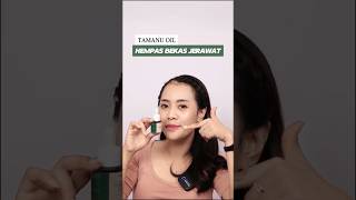 Tamanu Oil Hempas Bekas Jerawat🍃 [upl. by Inaliak]