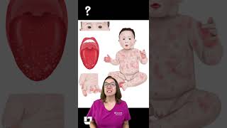 Decreased albumin with Kawasaki disease  Ask Nurse Cathy Pediatrics SHORT  LevelUpRN [upl. by Dey]