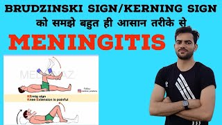 Meningitis के sign को समझे बहुत ही आसान भाषा मेंmengitis signkerning signBrudzinskisignytshortvi [upl. by Shantha]