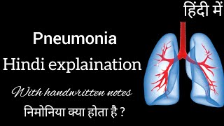 Pneumonia  Bacterial disease  Lobar pneumonia  Bronchopneumonia  Hindi Explanation [upl. by Frans929]