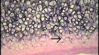 Cartilage and Bone Histology FreeMedEd [upl. by Nonah]