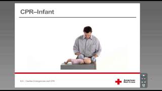 CPR  Infant [upl. by Alleyn]