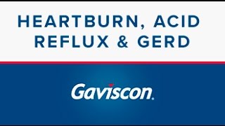 Heartburn Acid Reflux and GERD  Gaviscon® [upl. by Ecikram]