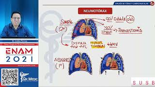 Neumotórax simple abierta y a tensión  Qx medic neumerology [upl. by Arley]