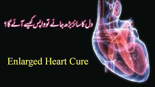 Dil ka size berh jae tou kya is ka ilaj mumkin hai  Increased Heart Size Problem [upl. by Nisotawulo664]