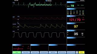 REALITi 113 Advanced ECG Controls [upl. by Pryce818]