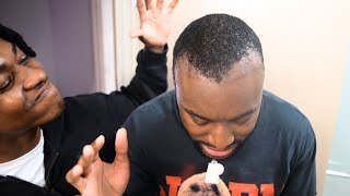 My Family DESTROYED My Hairline Surgery [upl. by Yltsew64]