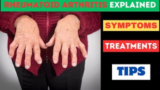 Rheumatoid Arthritis Explained Clearly All Your Questions Answered [upl. by Yarod]