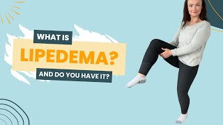 What is lipedema and do you have it [upl. by Roxanne]