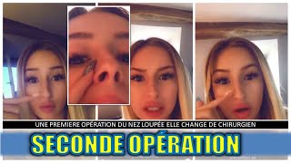 POLSKA CHIRURGIE ESTHÉTIQUE OPÉRATION DU NEZ LOUPÉE ELLE DÉCIDE CHANGER DE CHIRURGIEN [upl. by Inahs885]