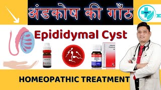 Epididymal Cyst Homeopathic Medicine  Best Treatment for Epididymitis  Dr Sunil Patidar [upl. by Kramer]