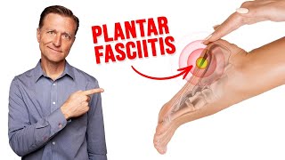 Fix Plantar Fasciitis Instantly NO MORE HEEL PAIN [upl. by Nauqed710]