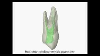 ThreeRooted Maxillary Premolar  Prof Marco Versiani [upl. by Zilla]