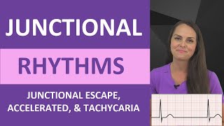 Junctional Rhythms Made Easy EKG Interpretation Nursing NCLEX ECG Review [upl. by Lindsy]