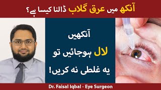 Eye Redness Ka Ilaj  Red Eyes Causes  Red Eye Infection Treatment  Aankhon Ka Laal Ho Jana [upl. by Hansiain64]