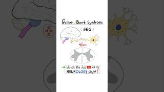 GuillainBarré Syndrome GBS  Part 2…anatomy biology science neuroscience nurse doctor [upl. by Meill]