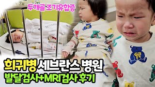 29개월 아기 소아신경외과  희귀병 병원 브이로그  발달 검사와 MRI 검사후 결과 세브란스 병원 두개골조기유합증 세브란스 전공의 파업 수술 일정 딜레이 [upl. by Marolda]