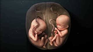 Twins pregnancy week by week जुड़वा बच्चे क्यों होते हैं [upl. by Gnot]