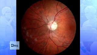 How COVID19 amp Other Illnesses Can Affect Your Eyesight [upl. by Yleoj459]