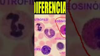 🩸Que significa tener NEUTROFILOS EOSINOFILOS Y MONOCITOS Altos🔬 shorts [upl. by Antoinetta]