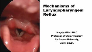 Mechanisms of Laryngopharyngeal Reflux [upl. by Baxter]