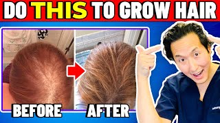 How to Treat Thinning Hair The Holistic Way [upl. by Howenstein362]