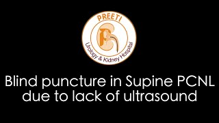 Blind puncture in Supine PCNL due to lack of Ultrasound [upl. by Maurizio]