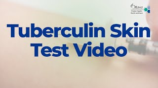 Tuberculin Skin Test Video  2022 [upl. by Skilken983]