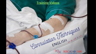 Mastering Cannulation Techniques English for Dialysis AV Fistula Tips and Tricks [upl. by Nesyt]