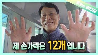 손가락 발가락 다 합치면 24개 희귀 다지증의 스마일 맨의 꿈┃Fingers  Toes  24 The Dream of a Man with Polydactylism [upl. by Elonore]