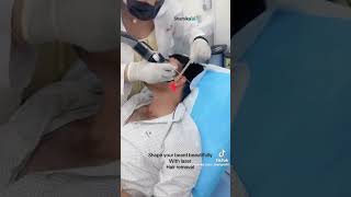 ✅Shaped your beard beautifully with laser hair removal hairremoval laserbeauty explore [upl. by Ameyn]