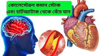 Good cholesterol and bad cholesterol  HDL and LDL in Bangla [upl. by Arick146]