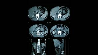 RADIOLOGY EXAM CASES [upl. by Nrojb]