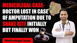 medicolegal case y doctor lost in case of amputation due to snake bite initially but finally won [upl. by Colvert]