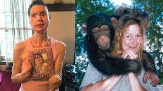 La impactante historia de Charla Nash la mujer atacada por un chimpancé [upl. by Wrdna]