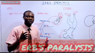 ERBS PARALYSIS MADE EASY WITH MNEMONICS [upl. by Jamill]