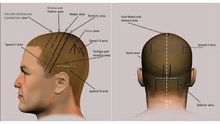 SCALP ACUPUNCTURE Locations and Indications of Areas Jiao SA [upl. by Eugatnom]