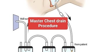 Chest drainage overview with aim steps procedure complications and aftercare [upl. by Garin]